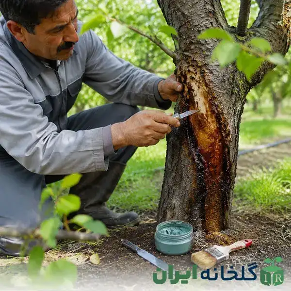 درمان گموز با جراحی و بردوفیکس